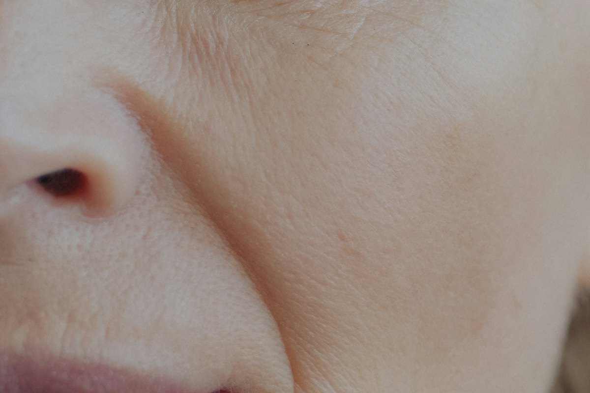 Skin in your 40s: what changes and what to do about it